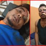 Dua Wartawan Babak Belur Dihajar Oknum TNI Denzipur 12 Nabire