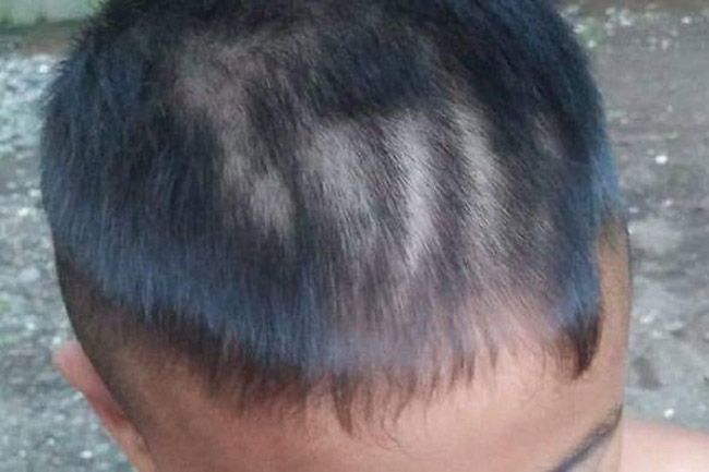 Oknum Guru Banyuwangi Cukur Rambut Murid Tak Beraturan Hingga Luka