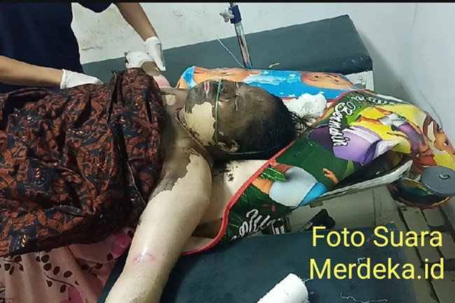 Tanpa Sebab, Seorang Wanita di Muna Membakar Dirinya Sendiri