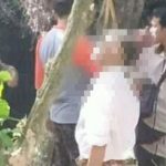 Takut Jalani Operasi Prostat, Sapuan Pilih Gantung Diri